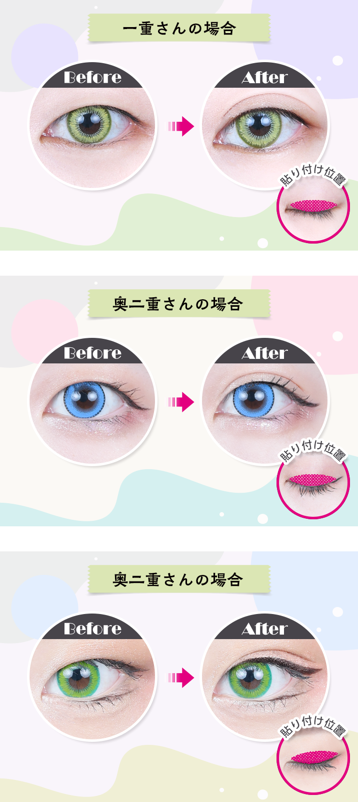 ポイント