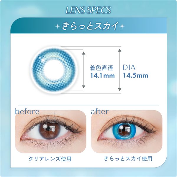 きらっとスカイ